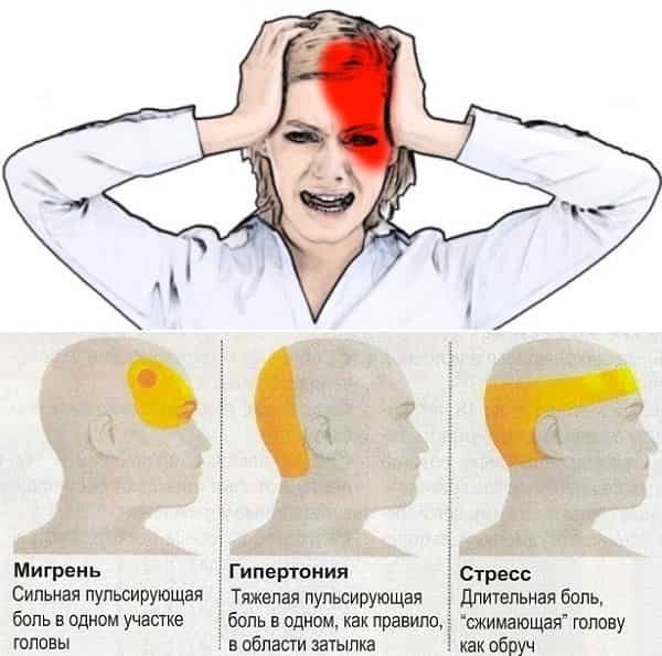 Psihosomatika-migreni-2